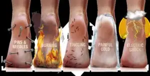 Diabetic Neuropathy